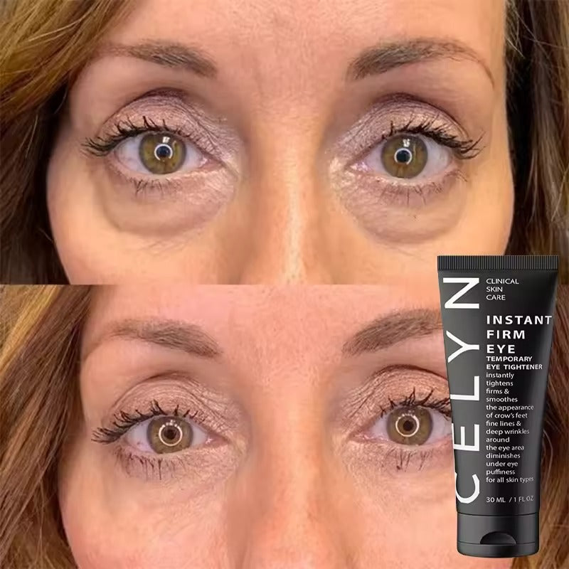 CËLYN by naari | Creme Anti-Olheiras e Antirrugas Instantâneo